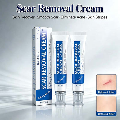 Professional Scar Removal Gel-Multi-Type Scar Carel For Keloids