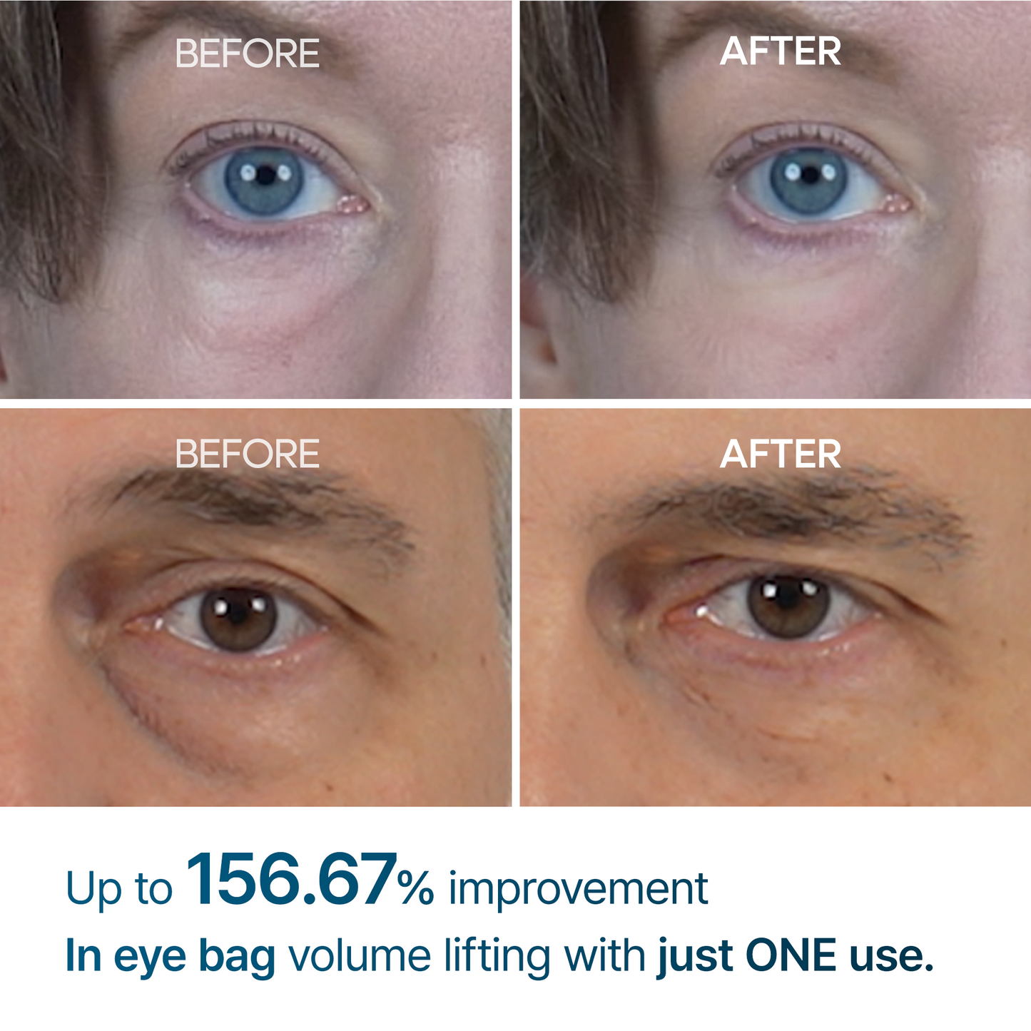 [Dr.Malex Official] Resurface Your Eyes Instantly 👁️