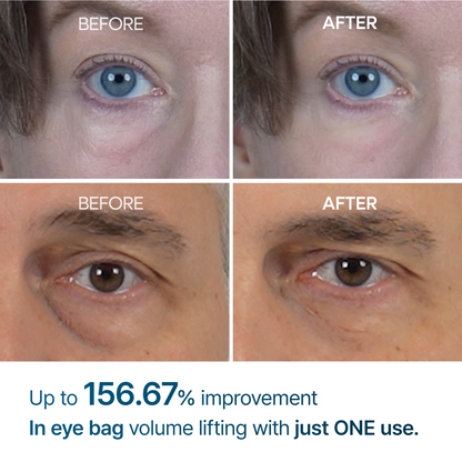 [Dr.Malex Official] Resurface Your Eyes Instantly 👁️