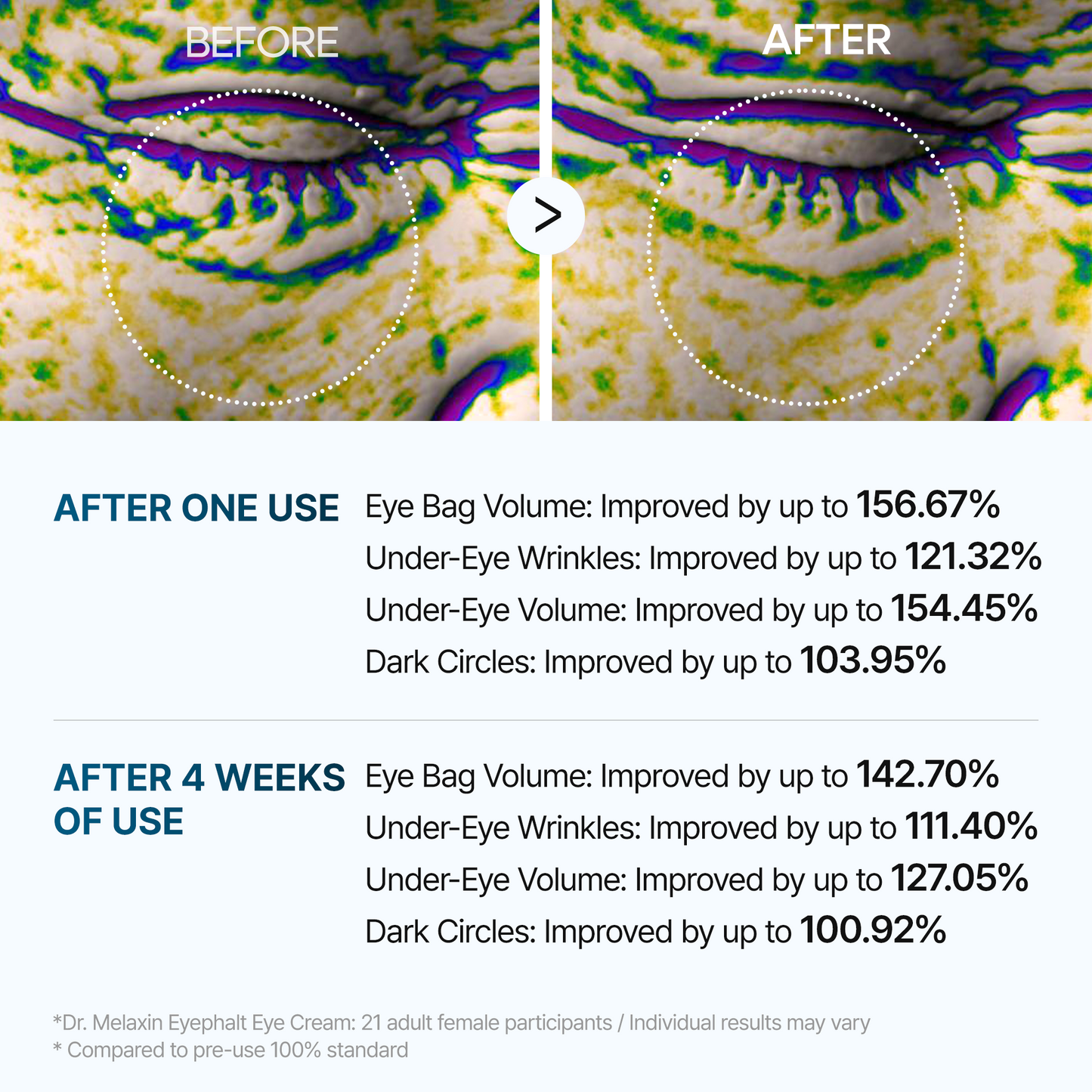 [Dr.Malex Official] Resurface Your Eyes Instantly 👁️