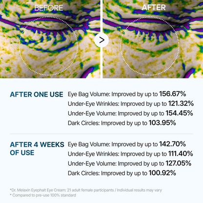 [Dr.Malex Official] Resurface Your Eyes Instantly 👁️