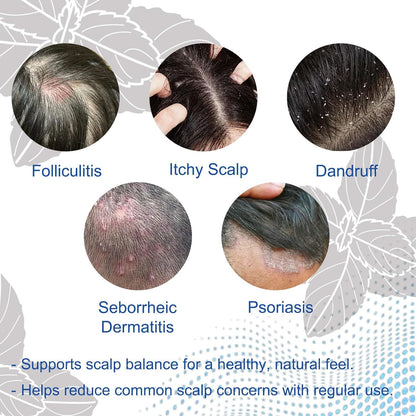 Folliculitis Shampoo for Itchy, Flaky Scalp - Purifying Formula for a Soothed