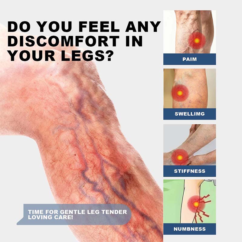 Common tired-leg discomfort areas